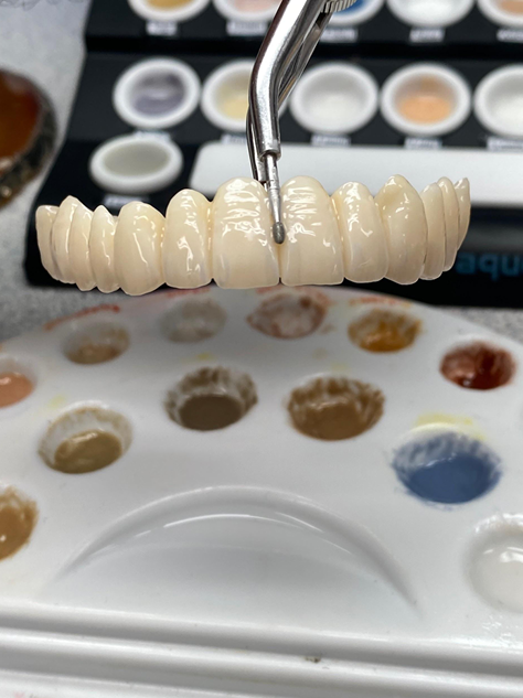 Monolithic Zirconia Crowns photo 1